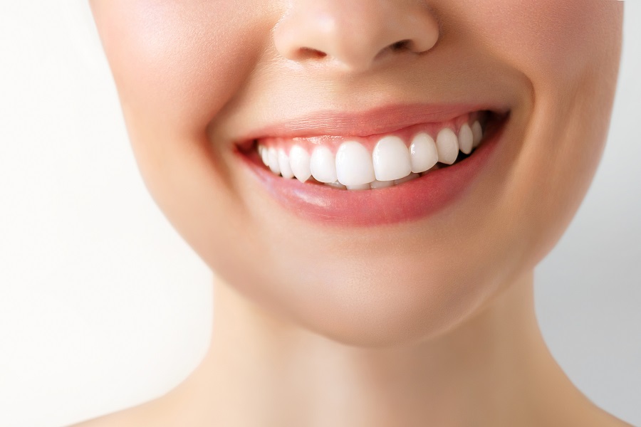 The Advantages of White Fillings for a Natural Smile