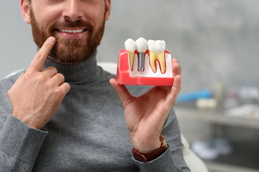 Dental Implants: The Best Solution for Missing Teeth