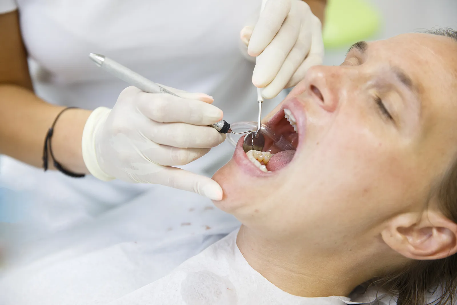Oral Hygiene After a Root Canal: How to Care for Your Treated Tooth